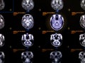 Selective focus of MRI brain axial view