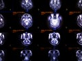 Selective focus of MRI brain axial view