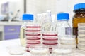 Selective focus of stack of petri dish with agar and test tube with broth. Disease, medical and microbiology laboratory research.