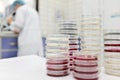 Selective focus of stack of petri dish with blurred male scientist working on a microscope on a microbiology laboratory background