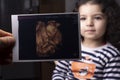 Selective focus of an unborn baby sonography image in front of two years old girl