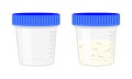 Semen analysis. Sperm sample plastic container empty and full isolated on white background. Male infertility test. Sperm Royalty Free Stock Photo