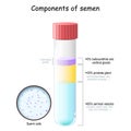 Semen components. Test tube with sperm cells Royalty Free Stock Photo