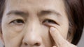 Senior asian woman worry about eye bags and dark spot