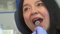 Woman opens her mouth for dental check up Royalty Free Stock Photo