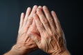 Senior citizens hands ache, a reminder of lifes wear and tear Royalty Free Stock Photo