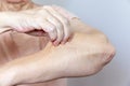 A senior elderly woman holding, pulling the skin on her arm with bad turgor, exces loose skin Royalty Free Stock Photo