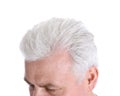 Senior man with hair loss problem on white, closeup