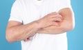 Senior man scratching forearm on color background. Allergy symptom Royalty Free Stock Photo