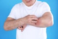 Senior man scratching forearm on color background. Allergy symptom Royalty Free Stock Photo