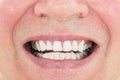Senior Man Showing His Teeth Royalty Free Stock Photo