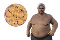 A senior overweight man with a close-up view of adipocytes, 3D illustration highlighting the role of these fat cells in Royalty Free Stock Photo