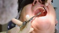 Senior woman getting dental implant