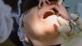 Senior woman getting dental implant Royalty Free Stock Photo