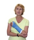 Senior woman with painful arm in cast Royalty Free Stock Photo