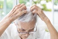 Senior woman scratching her head,itchy scalp and hair loss,allergic reaction to hair care product,allergies to shampoo or Royalty Free Stock Photo