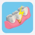 sensitive tooth. Vector illustration decorative design Royalty Free Stock Photo