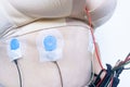 sensors on body for Holter monitoring, woman with Holter monitor daily monitoring of electrocardiogram, blood pressure, cardiac