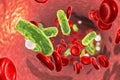 Sepsis, bacteria in blood