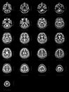 Sequence of horizontal sections of a human brain Royalty Free Stock Photo