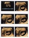 Images of 11 weeks pregnant show baby or fetus development and pregnancy