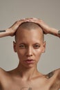 Serious bald girl touch head and look at camera Royalty Free Stock Photo