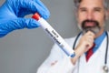 Serious mature doctor with test tube of Omicron variant Royalty Free Stock Photo