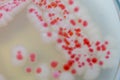 Serratia marcescens is a species of rod-shaped gram-negative bacteria.