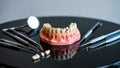 Set of Artificial Gums with Broken and Crooked Front Teeth on Black Reflective Surface with Dental Tools Royalty Free Stock Photo