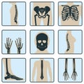 Set of bone, chest x-ray concept icon, roentgen human body image isolated on white, flat vector illustration. Skeleton part of man Royalty Free Stock Photo