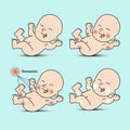 Set dermatitis baby Royalty Free Stock Photo