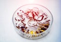 Set of different dental tools in a glass basin on the light background