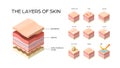 set different types skin layers cross-section of human skin structure skincare medical concept flat horizontal