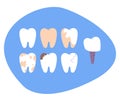 Set of diffrent impacts on human teeth. Dental and oral diseases.