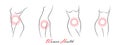 Set of elegant woman silhouettes in a linear sketch style. Woman body correction with the help of plastic surgery concept