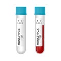 Set of empty tube and blood sample tube with Monkeypox virus test isolated on white background.