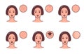 Set of female faces with various skin conditions and problem. Skincare and dermatology concept. Vector colorful