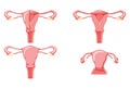 Set of Female reproductive system uterus in different styles and cross sections. Front view in a cut. Human anatomy Royalty Free Stock Photo