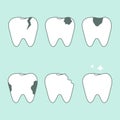 Set of healthy and unhealthy teeth Royalty Free Stock Photo