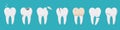 A set of human teeth with different injuries. Healthy and diseased tooth, caries, broken root, plaque, spots, crack. Banner,