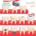 A set of human teeth with various injuries. Healthy and diseased tooth, caries, broken root, plaque, spots, crack