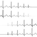 Set icons symbol death resurrection, vector, symbol heartbeat attenuation and resuming of the heart beats Royalty Free Stock Photo