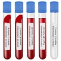 Set of isolated coronavirus blood tests. full and empty test tubes with labels. positive and negative tests