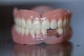 Set of medical denture on dark table Royalty Free Stock Photo