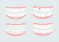 Set of teeth vector