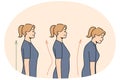 Set of young woman posture problems Royalty Free Stock Photo