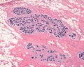 Human mammary gland. TDLU