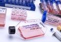 Several vials positive for covid-19 infection of the new variant in the south africa Royalty Free Stock Photo