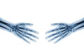 Shake hands . X-ray normal human hands Royalty Free Stock Photo
