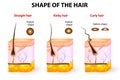 Shape of the hair and hair anatomy Royalty Free Stock Photo